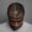 mens hair loss treatment in australia